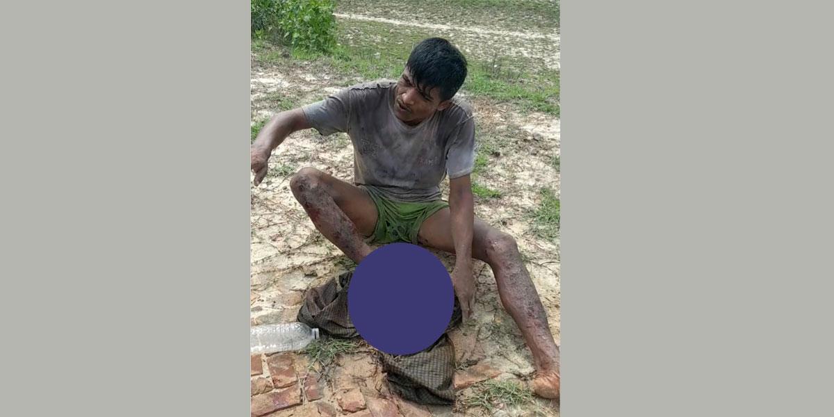 উখিয়া সীমান্ত এলাকায় ল্যান্ডমাইন বিস্ফোরণে উড়ে গেল যুবকের পা