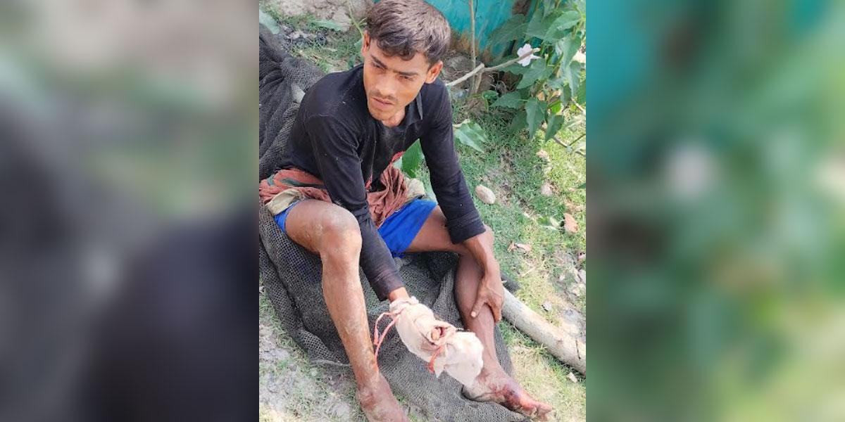 আরাকান আর্মির গুলিতে রোহিঙ্গা যুবক আহত