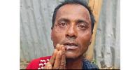 হাতে কামড় দিয়ে বখাটের কবল থেকে রক্ষা পেল স্কুলছাত্রী