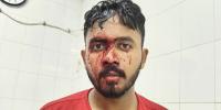 জবি শিক্ষার্থীদের সঙ্গে স্থানীয়দের সংঘর্ষ, সাংবাদিকসহ আহত  ১৩