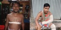 সোনারগাঁয়ে বাবা ছেলেকে কুপিয়ে জখম